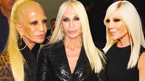 do atela versace|Donatella Versace face what happened.